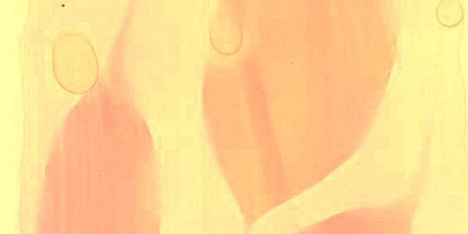 Antotipia com cúrcuma.
